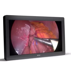 Surgical displays